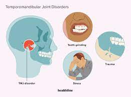 TMJ Disorders – Diagnosis and Treatment
