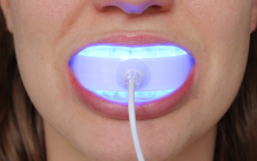 Is Glow Whitening Really Necessary? Find Out Here!